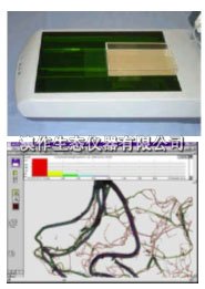 WINRHIZO根系分析系统